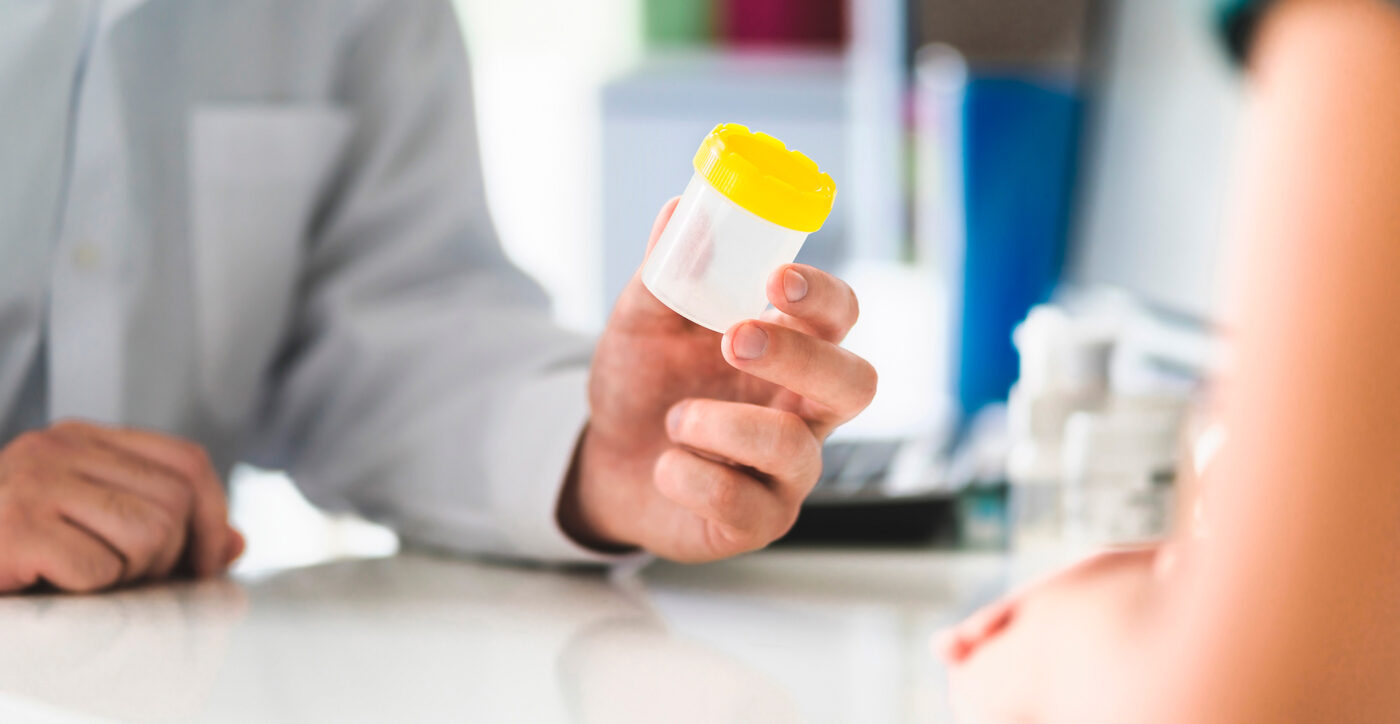 Un medico porge un vasetto per la raccolta delle urine a un paziente